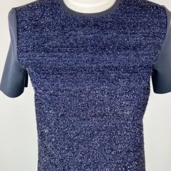 Tory Burch Blue Tinsel Dress - Picture 11 of 14